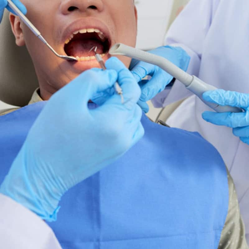 Wisdom Teeth Surgery